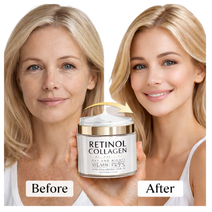 Retinol anti-aging face cream results showing before and after skin transformation with deep hydration and wrinkle care.